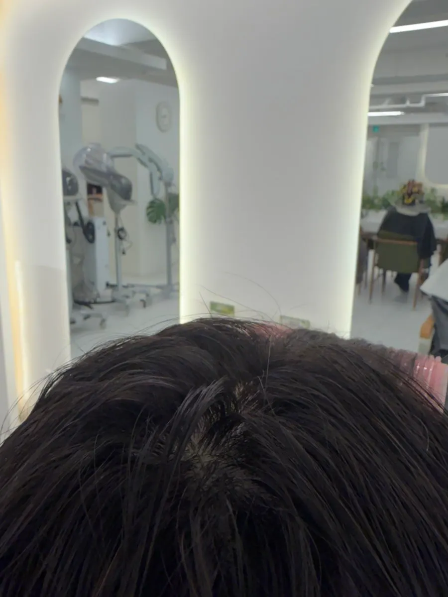 Hair mid-treatment showing revived root volume