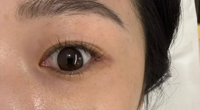 속눈썹 펌 전 처진 속눈썹 눈가 비교컷