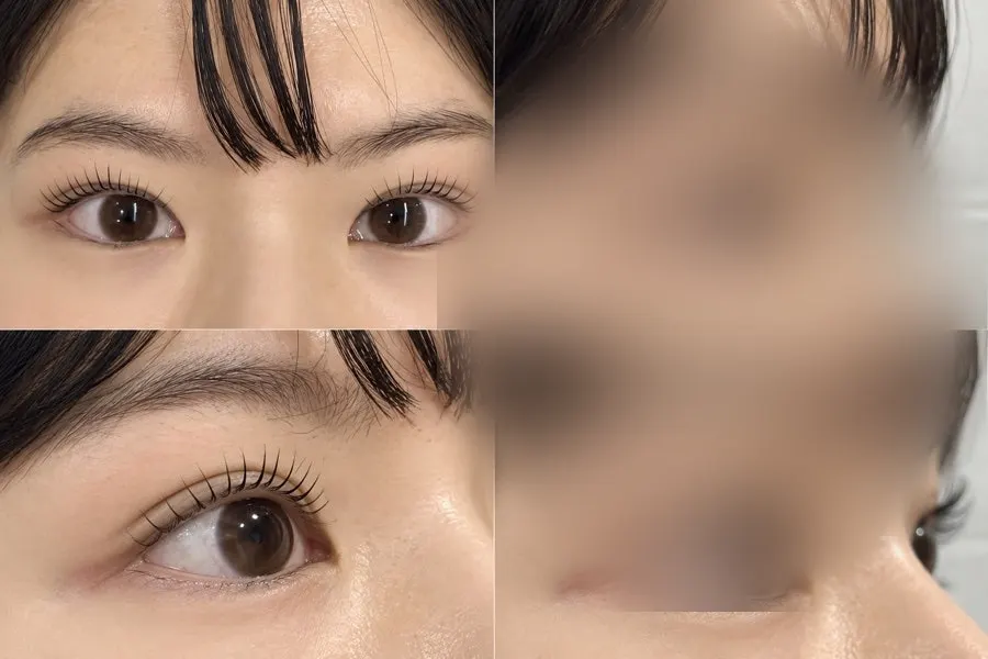 After photo of neatly aligned lashes viewed from the front