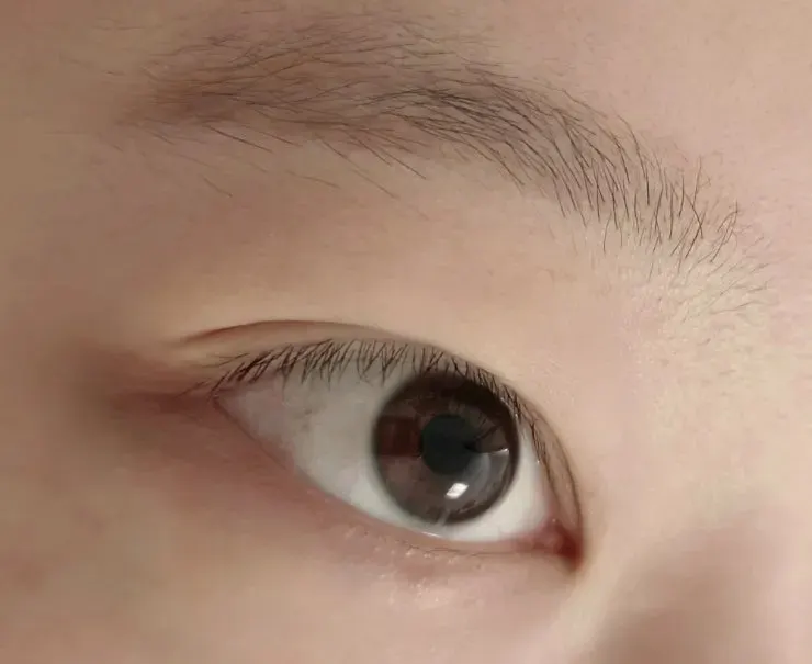 Eyebrows with tattoo traces remaining before treatment