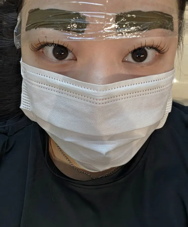 Face during treatment after the eyebrow sketch is finished