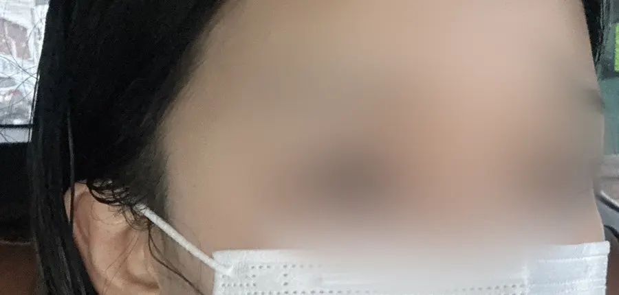 펌이 풀려 부시시한 시술 전 속눈썹