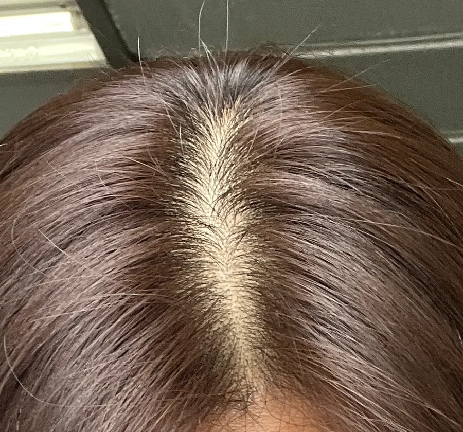 뿌리염색 전후 비교 사진