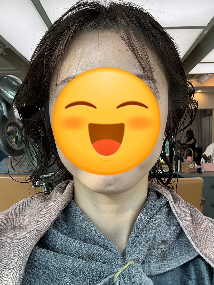 Front hair condition at the double-crown area