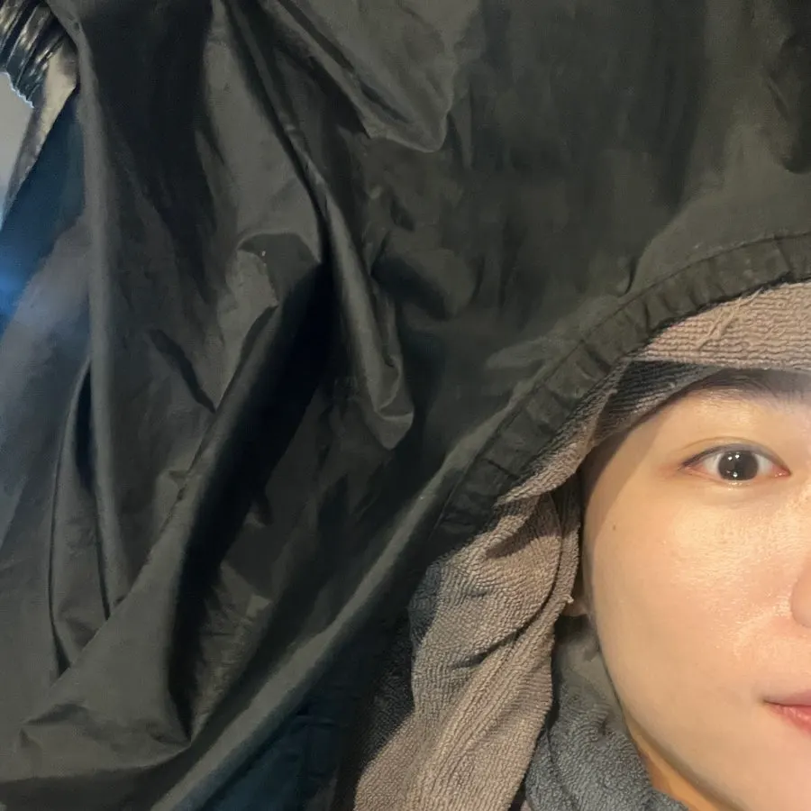 클리닉 3단계 진행 중인 모발