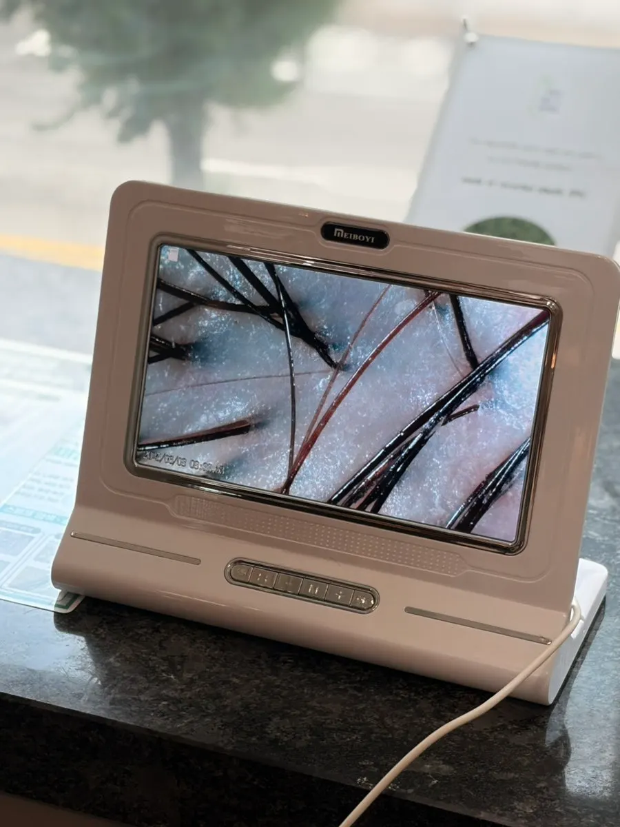 두피 진단 화면에 보이는 모공 상태