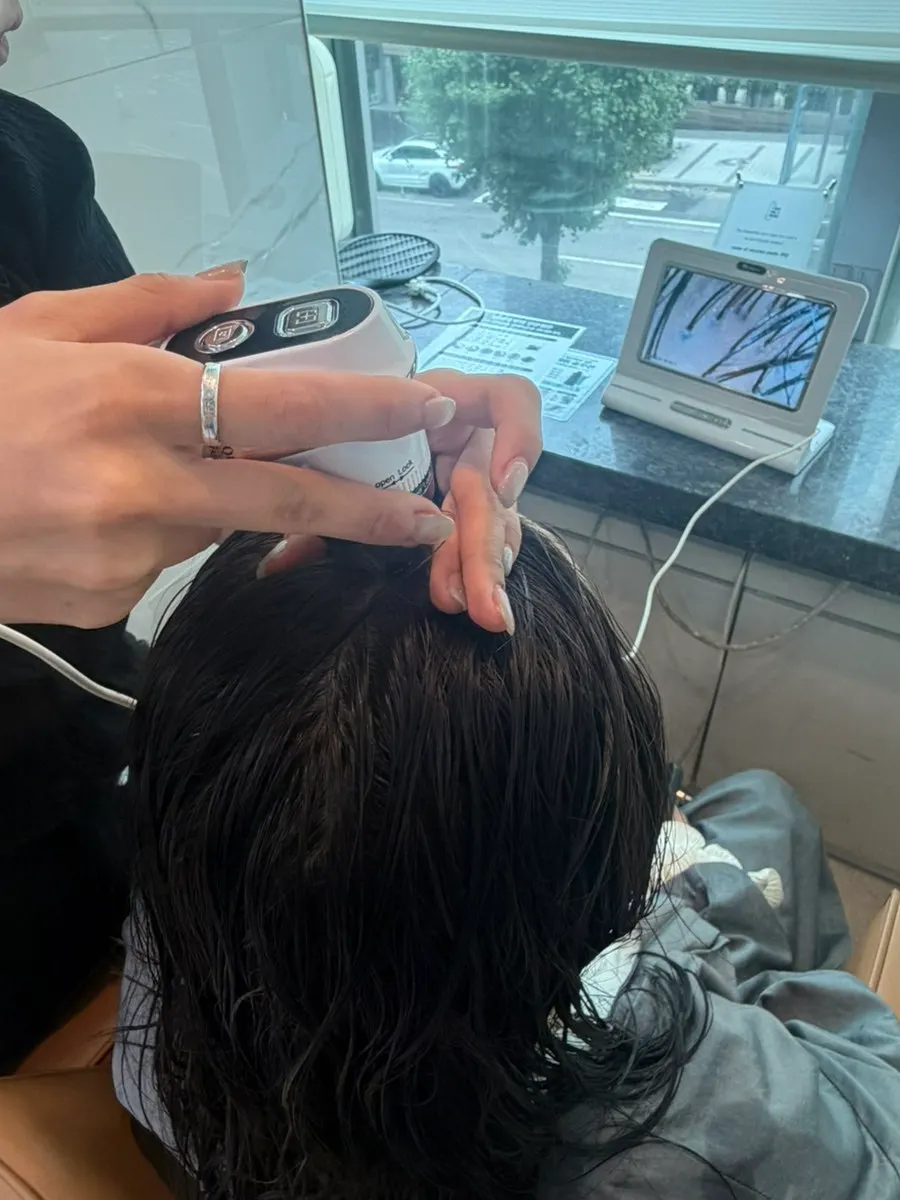 앰플 도포 후 진행하는 두피 마사지