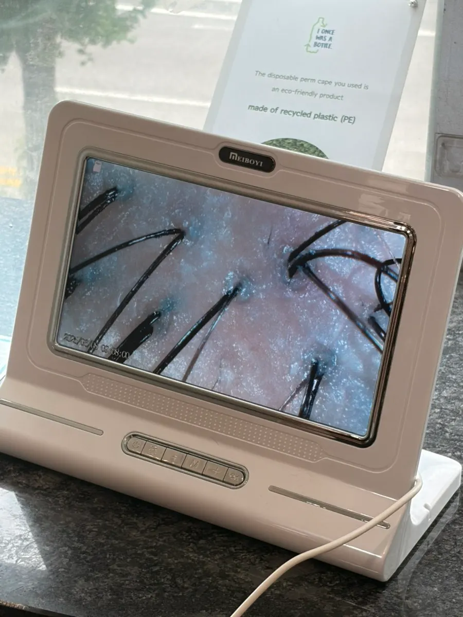 클리닉 후 다시 확인한 두피 상태