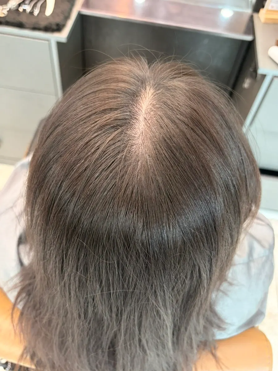 한남동 두피클리닉 자연건조 습관 모공 노폐물 제거, 온리포유 한남본점