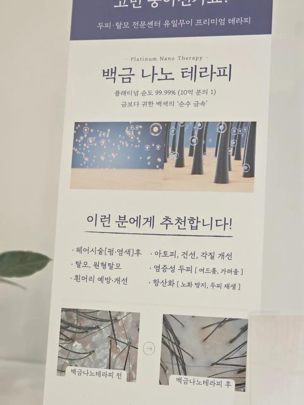 두피에 백금을 뿌리는 백금 테라피 과정