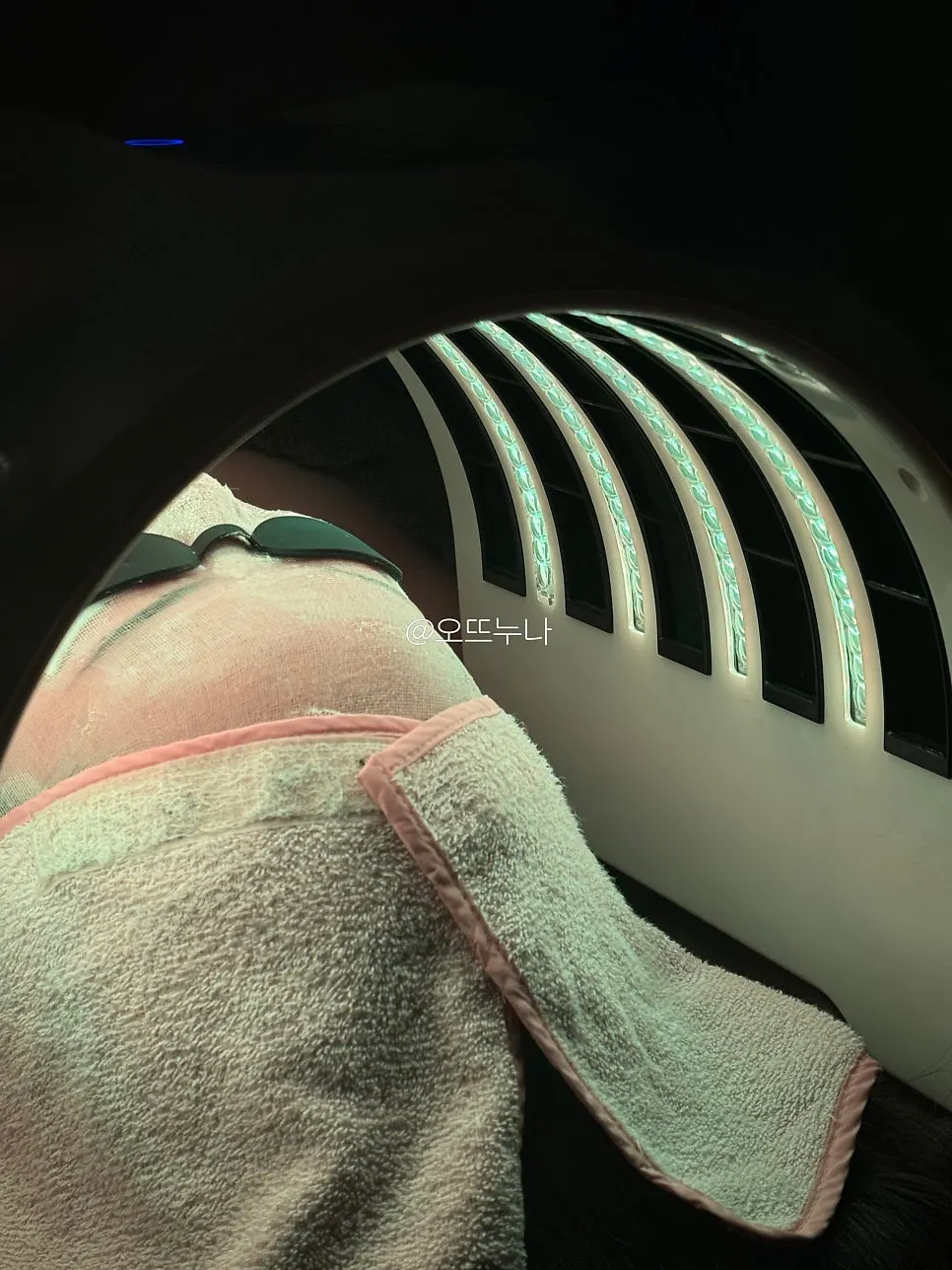 The last step: the LED dome treatment