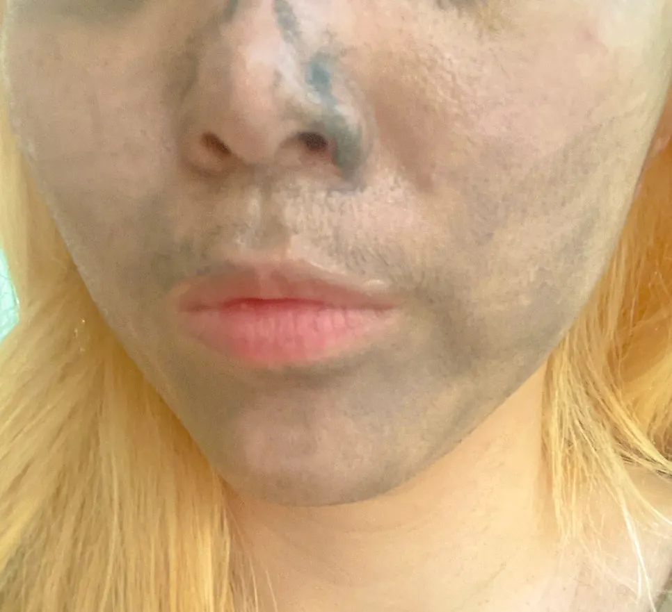 Charcoal cleansing balm for dry, blackhead-prone skin: HEEDA