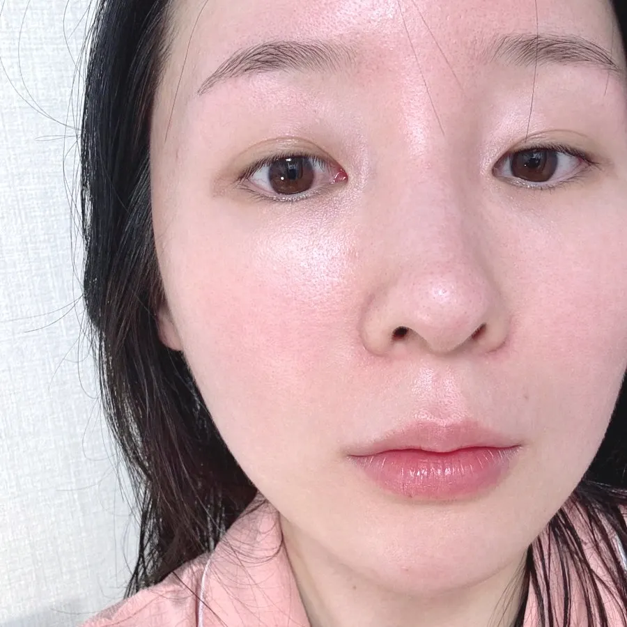 Cleansing balm for blackheads, tested 2 weeks: HEEDA