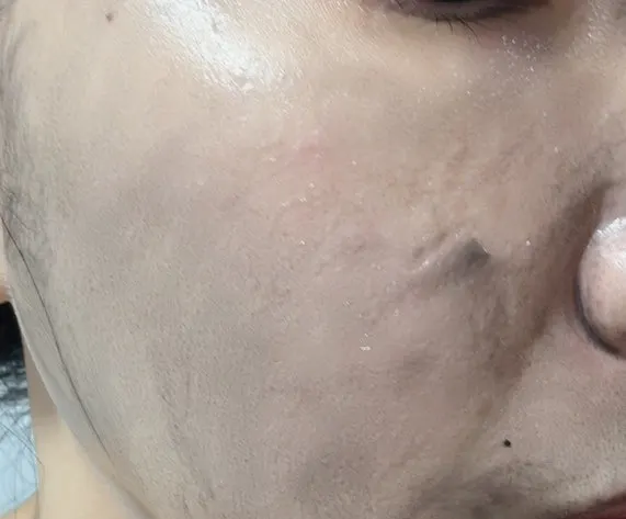 Makeup balm remover for oily skin and blackheads: HEEDA Charcoal Balm