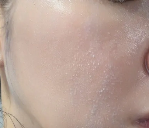 Makeup balm remover for oily skin and blackheads: HEEDA Charcoal Balm