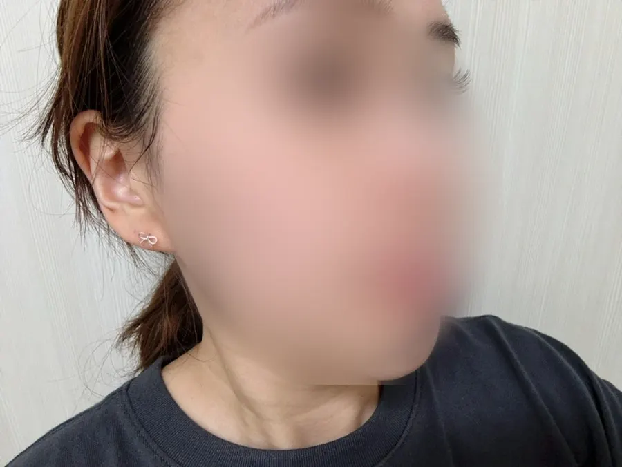 Cleansing balm for blackheads: HEEDA Jirisan Moist Charcoal
