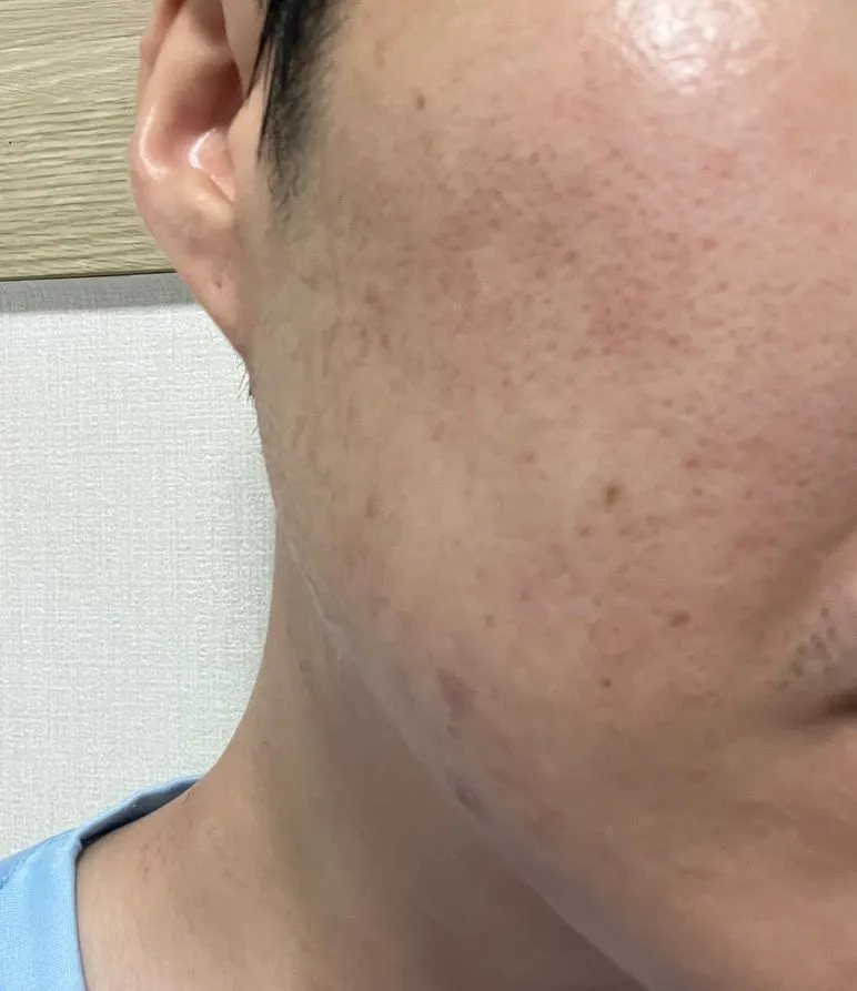 Charcoal cleansing balm makeup removal: HEEDA Jirisan Moist