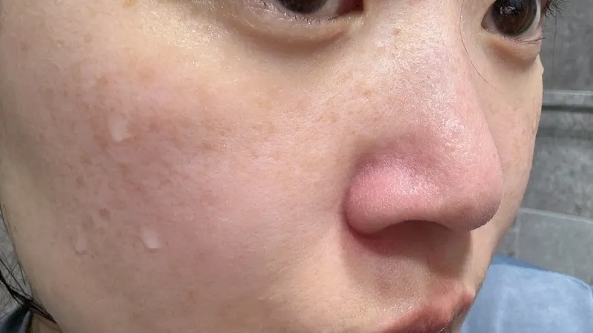 Cleansing balm for makeup removal on oily T-zone: HEEDA Jirisan