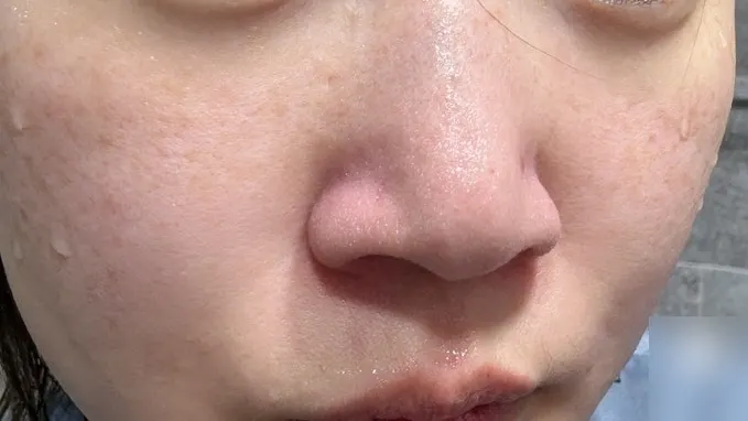 Cleansing balm for makeup removal on oily T-zone: HEEDA Jirisan