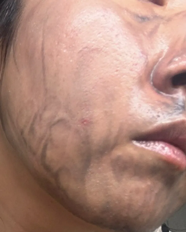 Cleansing balm for dehydrated oily skin: HEEDA Jirisan Charcoal