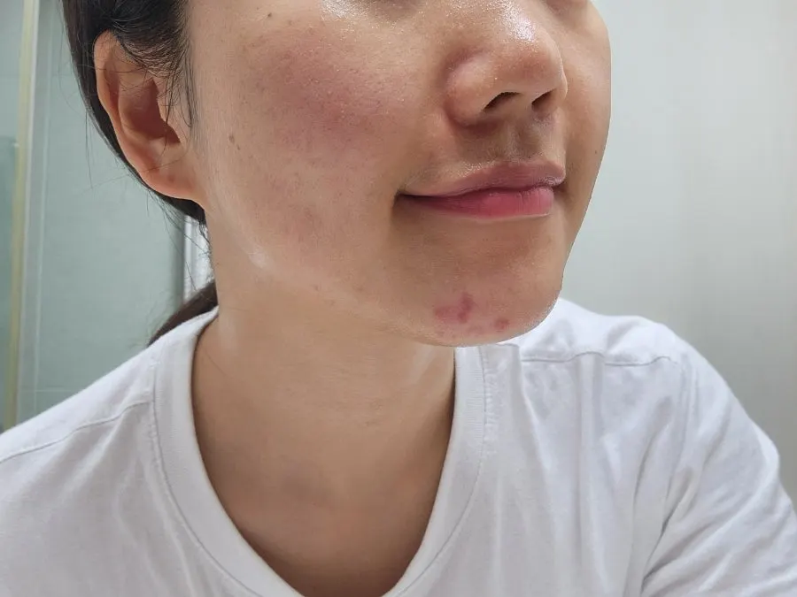 Cleansing balm for dehydrated oily skin: HEEDA Jirisan Charcoal