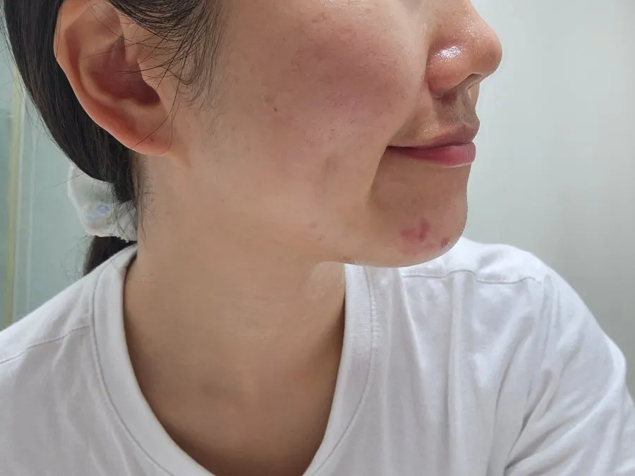 Cleansing balm for dehydrated oily skin: HEEDA Jirisan Charcoal