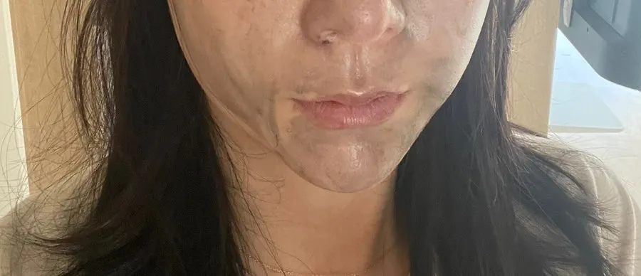 How to use a cleansing balm on dry combination skin: HEEDA Charcoal