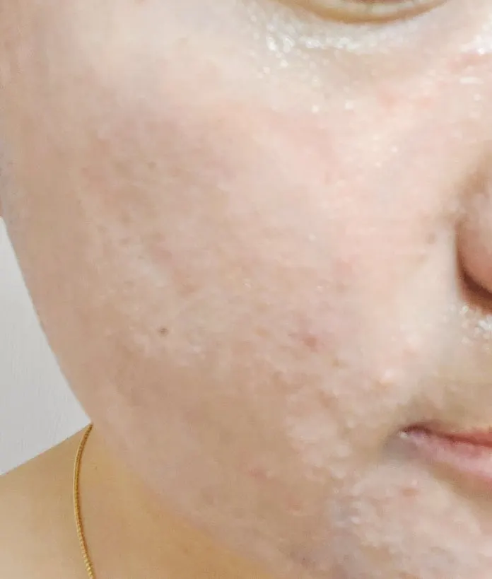 Cleansing balm for sensitive combination skin: HEEDA Charcoal Balm