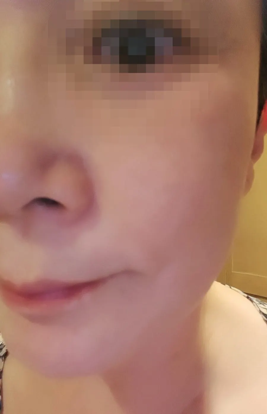 Blackhead cleansing balm for summer oily-dehydrated skin: HEEDA