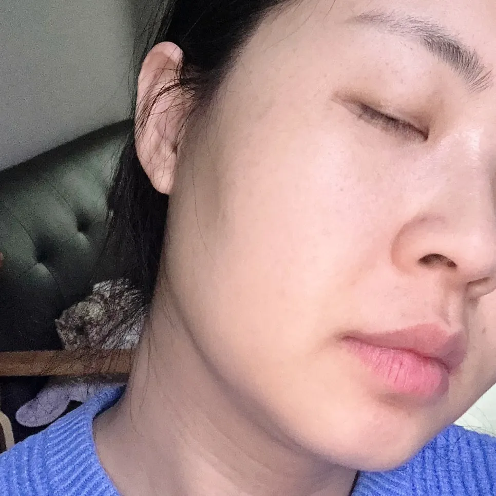 참숯 클렌징밤 2주 사용 후 피지 변화, 희다 지리산 촉촉 숯 클렌징밤