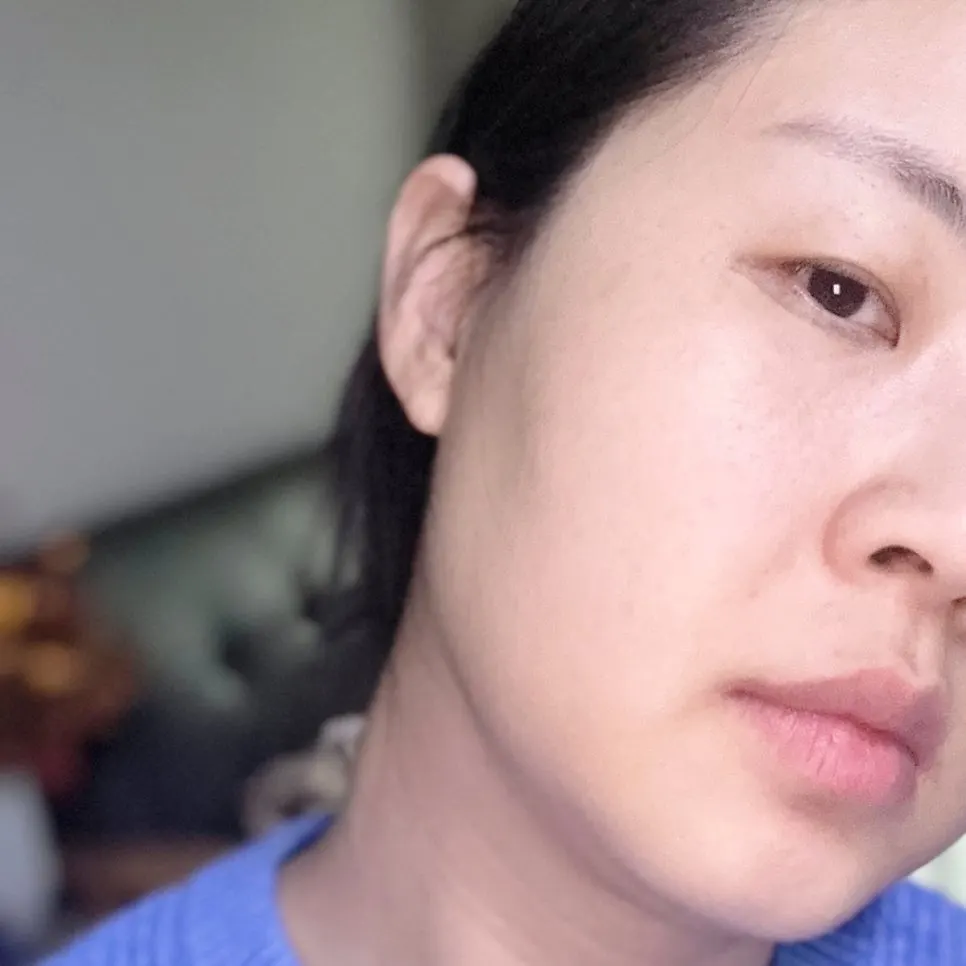 참숯 클렌징밤 2주 사용 후 피지 변화, 희다 지리산 촉촉 숯 클렌징밤