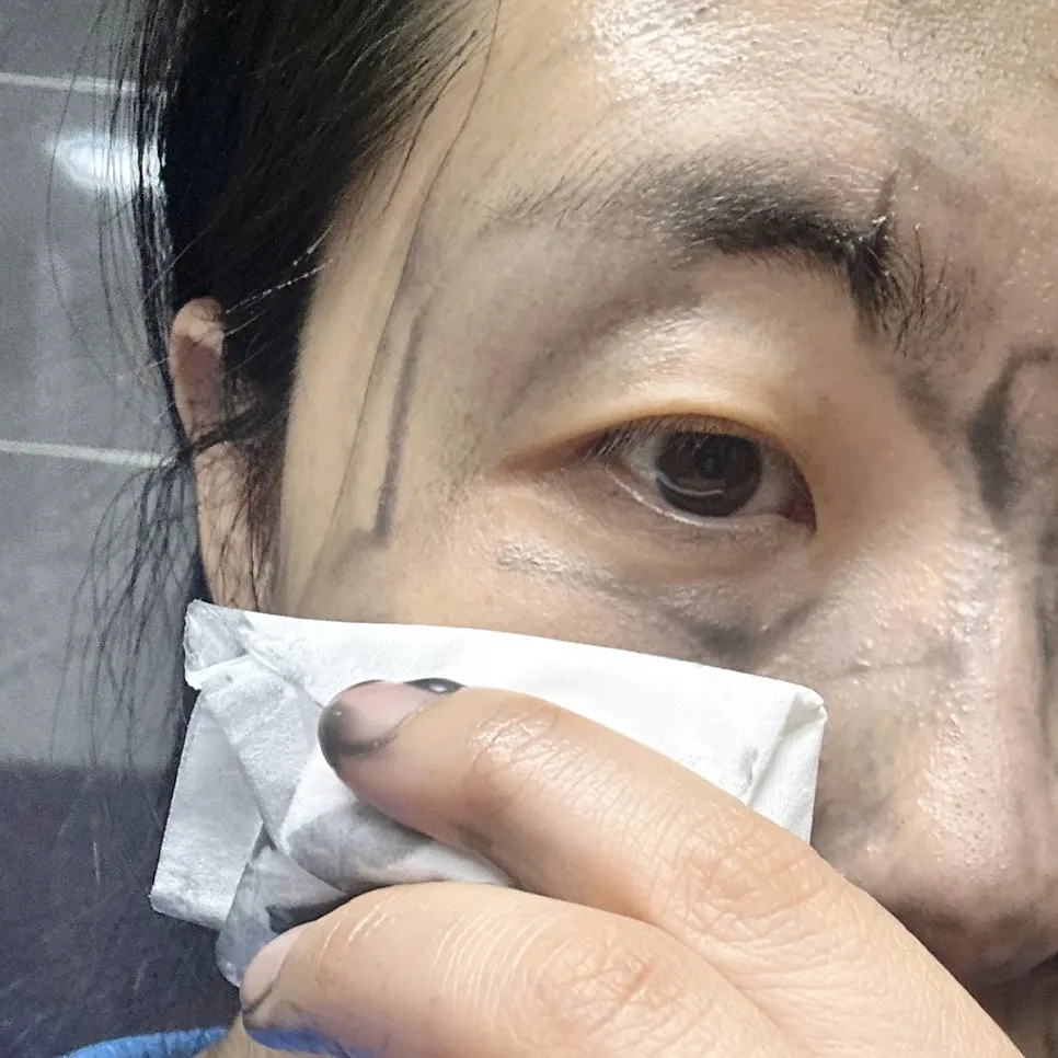 참숯 클렌징밤 2주 사용 후 피지 변화, 희다 지리산 촉촉 숯 클렌징밤