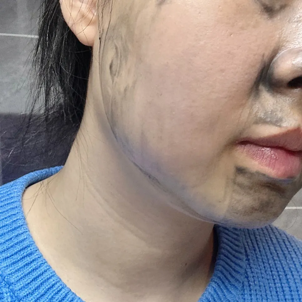 참숯 클렌징밤 2주 사용 후 피지 변화, 희다 지리산 촉촉 숯 클렌징밤