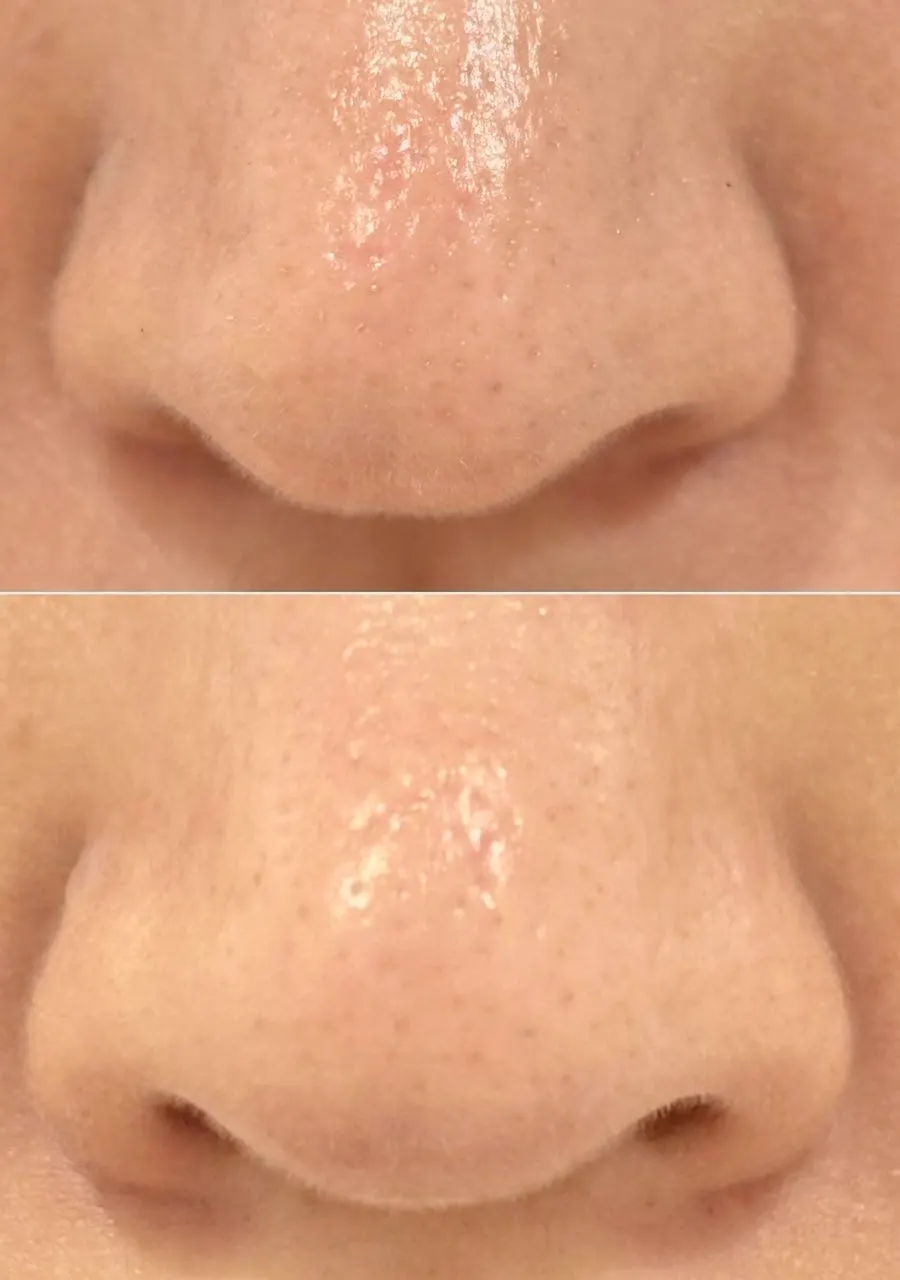 Cleansing balm for whiteheads and texture: HEEDA Jirisan Charcoal