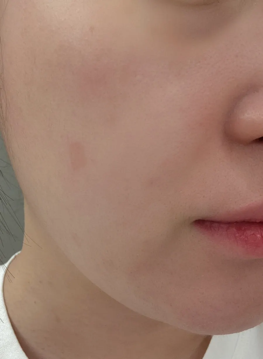 Winter cleansing balm for dehydrated oily skin: HEEDA