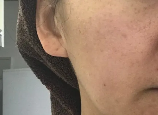 Charcoal cleansing foam for sensitive skin: HEEDA Jirisan
