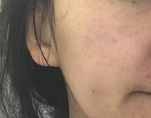 Charcoal cleansing foam for sensitive skin: HEEDA Jirisan