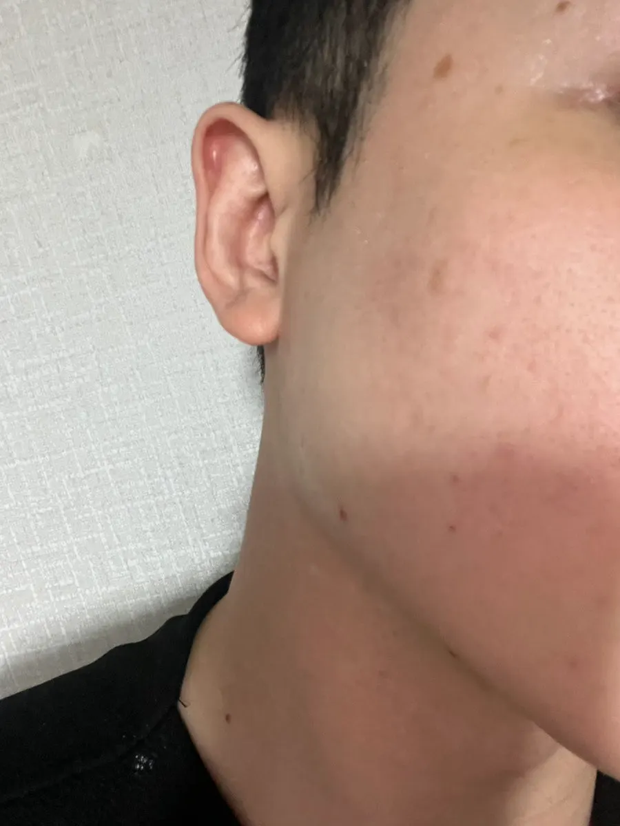 Low-pH cleansing foam for tight skin: HEEDA Jirisan Charcoal