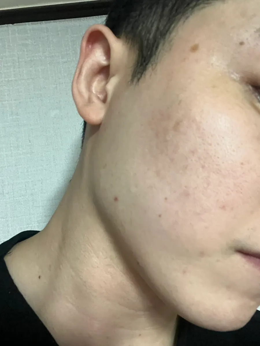 Low-pH cleansing foam for tight skin: HEEDA Jirisan Charcoal