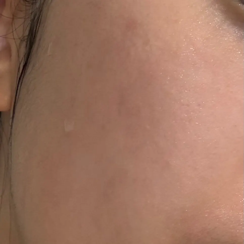 Skin condition after a morning-only cleanse