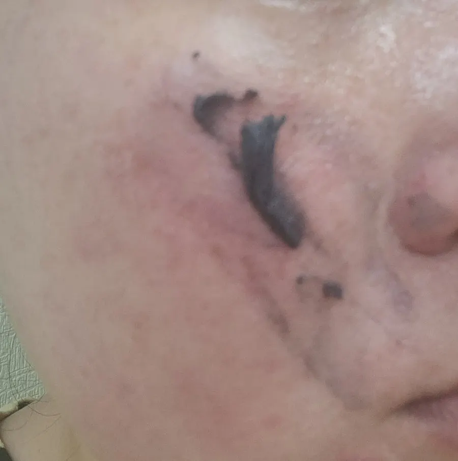 Charcoal cleansing balm for blackheads and pores: HEEDA