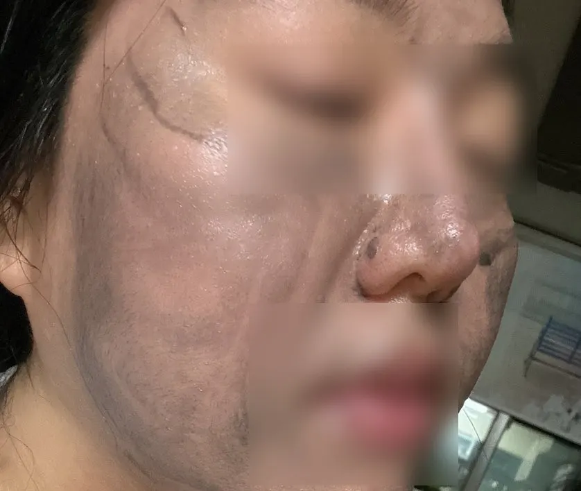 Korean charcoal cleansing balm for makeup removal: HEEDA