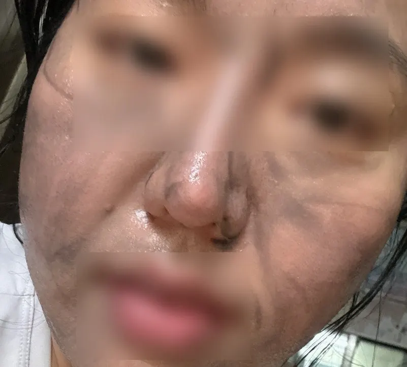 Korean charcoal cleansing balm for makeup removal: HEEDA
