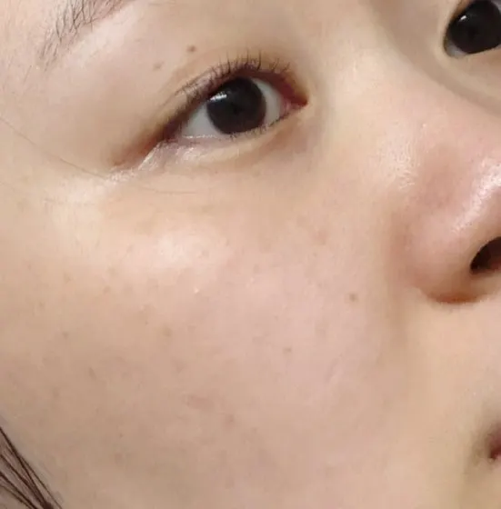 Charcoal cleansing balm for blackheads: HEEDA Jirisan Moist