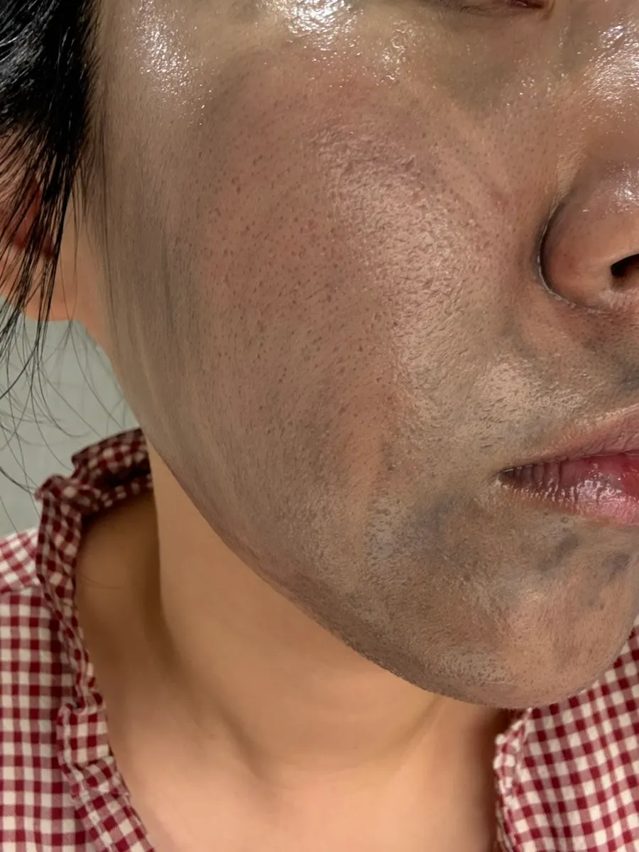 수분부족지성 클렌징밤 사용감, 희다 지리산 촉촉 숯 클렌징밤
