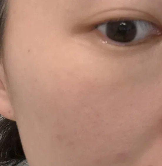 Face brightening serum for sensitive, red-prone skin: HEEDA