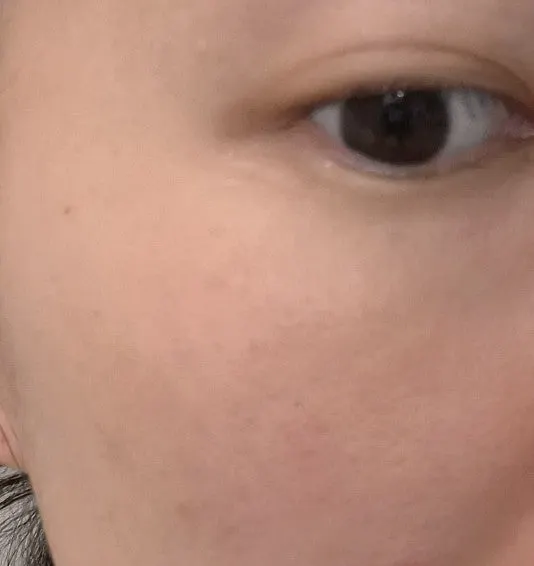 Face brightening serum for sensitive, red-prone skin: HEEDA