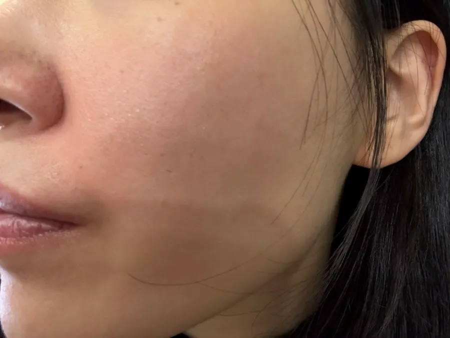Glutathione glow serum for dull skin, 2-week test: HEEDA