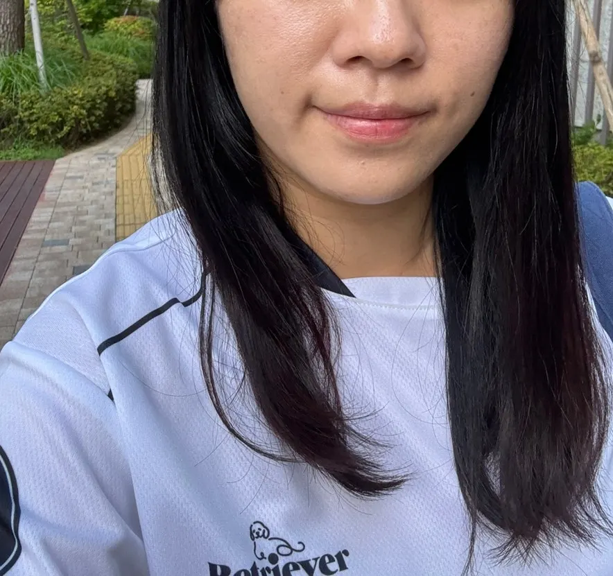 Face showing calmer breakouts after a few days of use