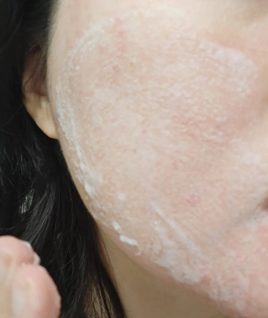 Low-pH cleansing foam for sensitive skin: HEEDA
